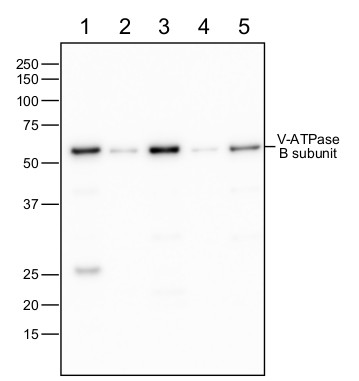 western blot using anti-V-ATPase subunit B antibodies